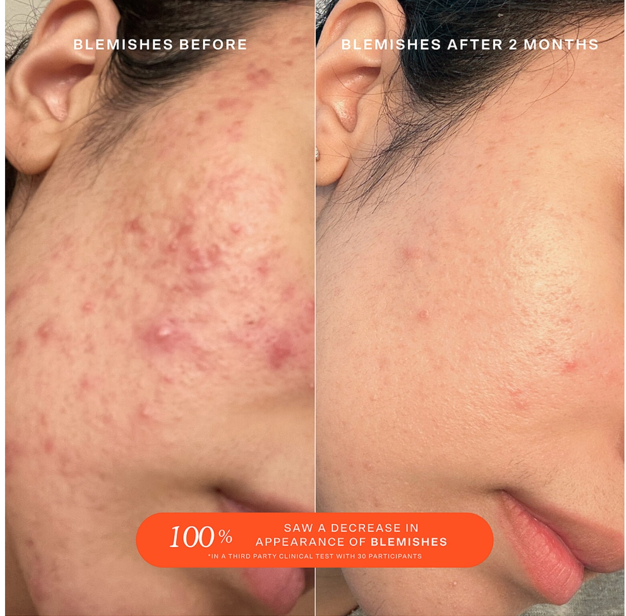 Wound Recovery Spray