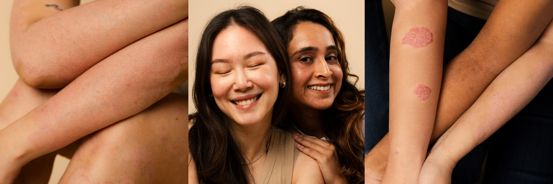 Real stories from real people