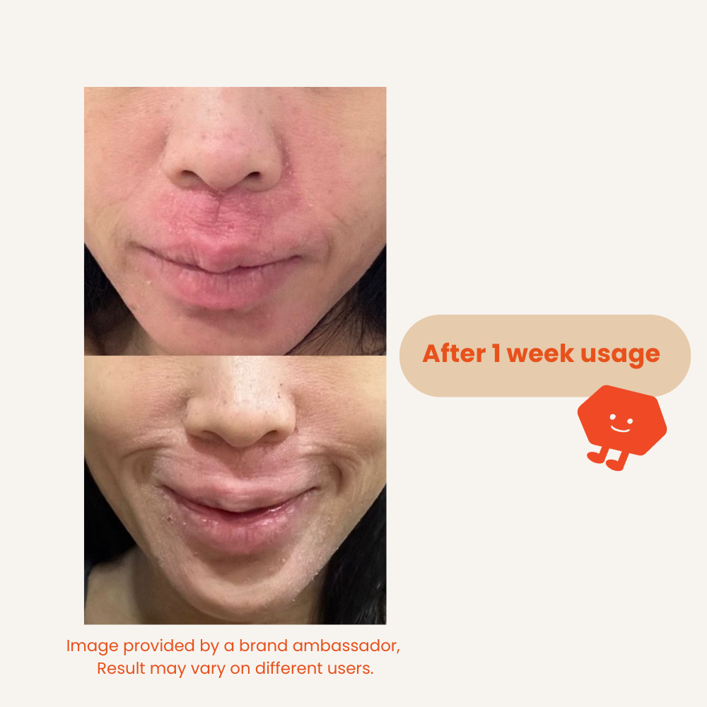 Hypochlorous Acid Spray