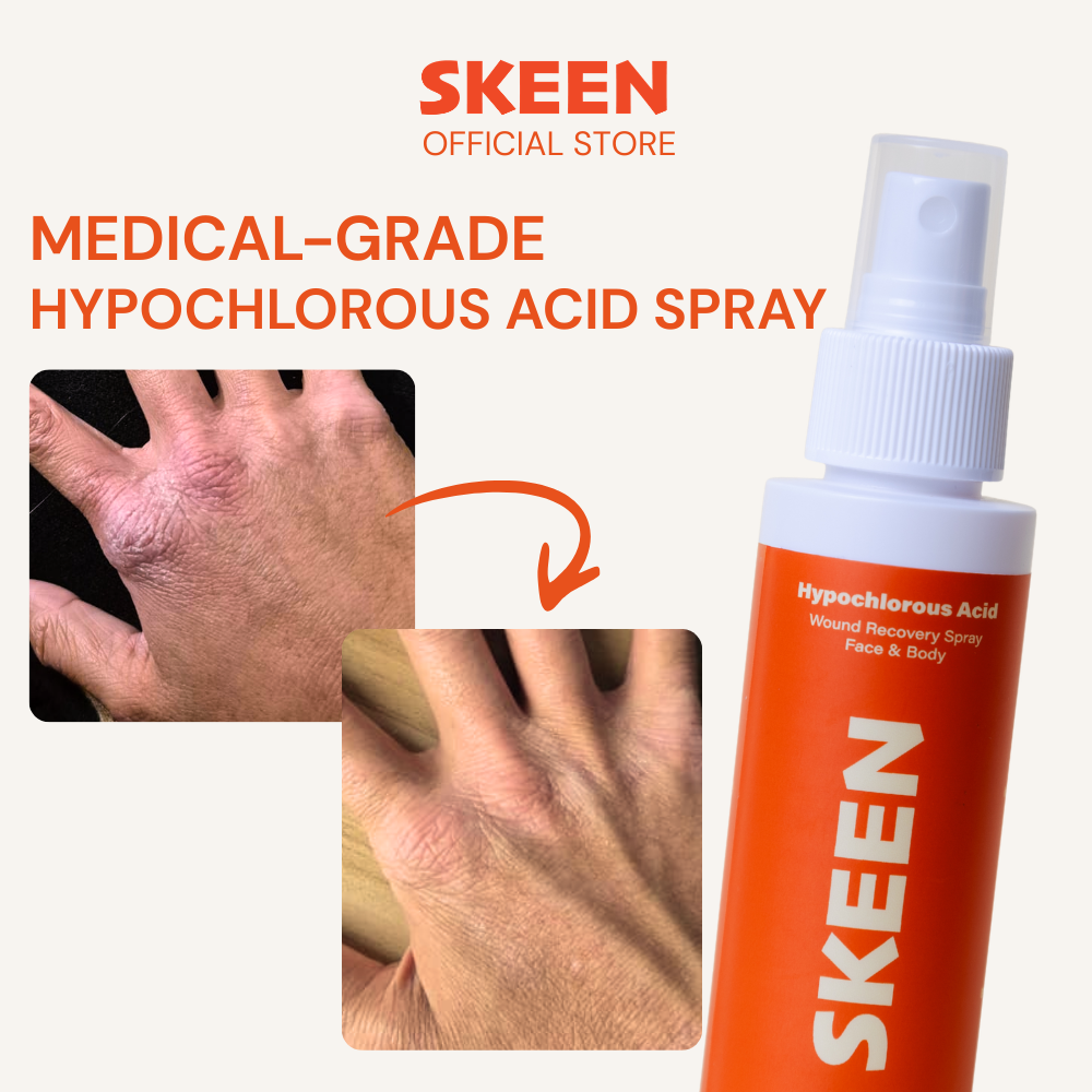 Hypochlorous Acid Recovery Spray