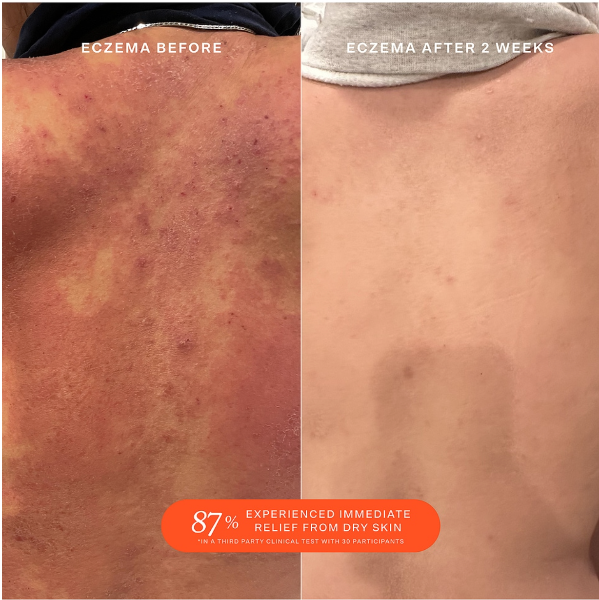 Wound Recovery Spray